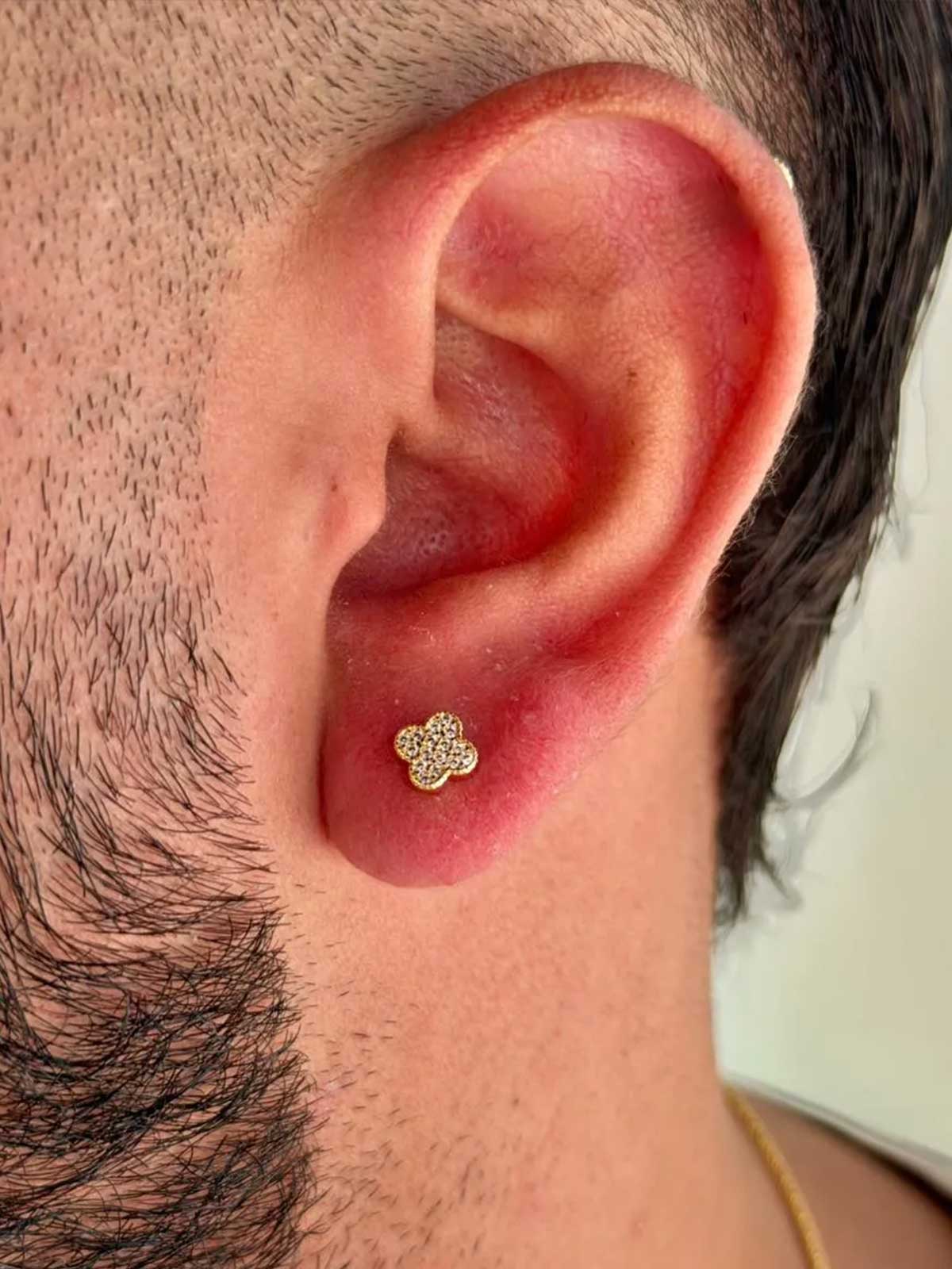 Arete Luck Clover 7 mm
